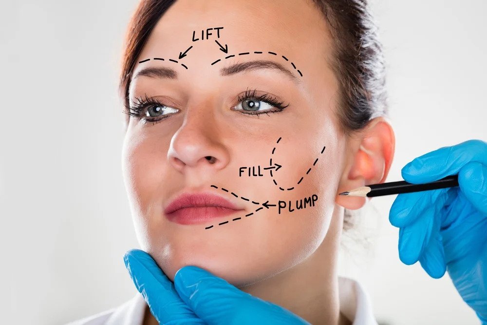 Facelift Surgery Atlanta