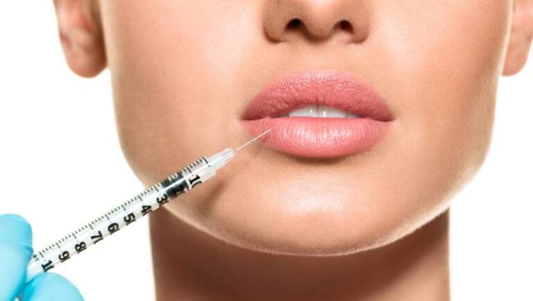 Lip filler: What to expect during and after the procedure?